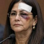 गिरफ्तारीका क्रममा मदुरोकी पत्नीलाई 'गम्भीर चोट' लागेको वकिलको दाबी 612763053_10235636503345568_1051867822103407333_n